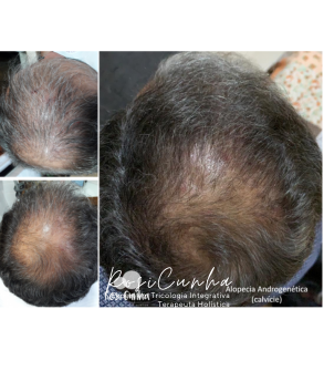 Inserir um pouquinho de texto (4).png