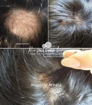 Inserir um pouquinho de texto (1).png